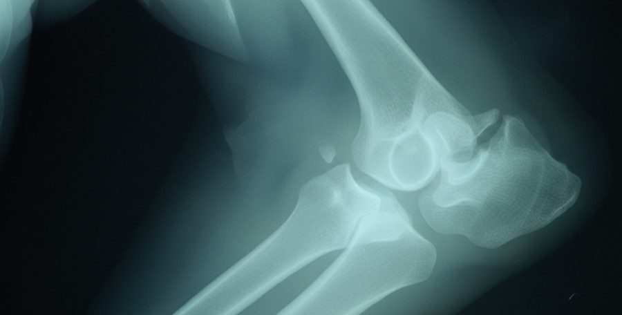 Displasia de codo en perros: señales, causas y cómo mejorar su calidad de vida displasia de codo perros e1768984653914 - Displasia de codo en perros: señales, causas y cómo mejorar su calidad de vida